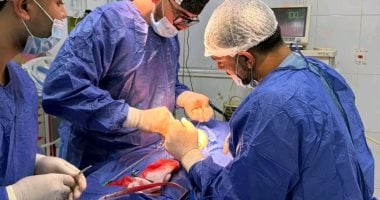 نادر جدًا في مصر: استخراج توأم من صدر رضيع بالشرقية