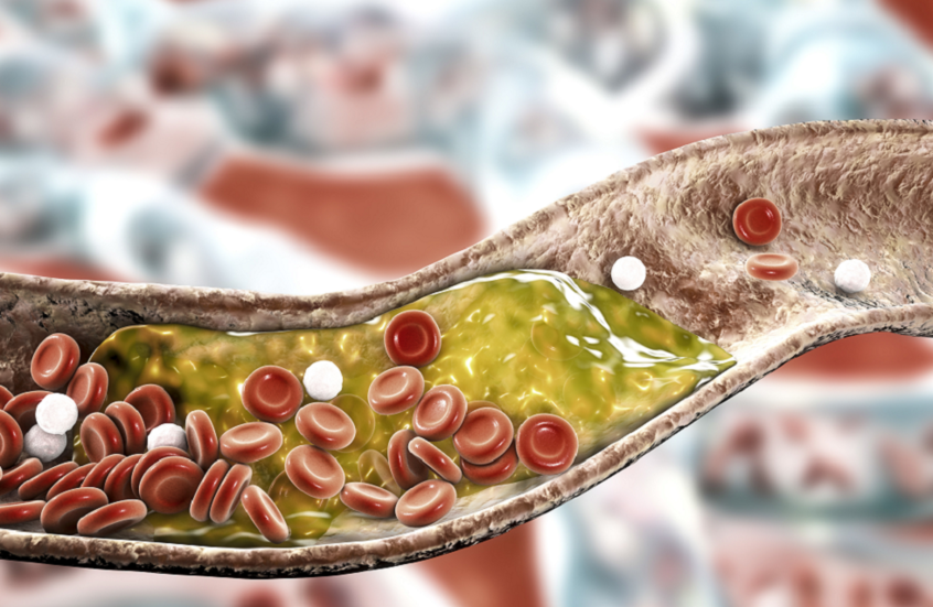دراسة تحسم الجدل حول "سمّية" جينات إنسان نياندرتال