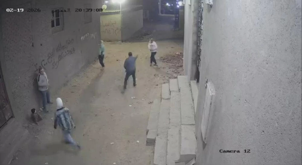 طفل باسوس يجرى جراحة بمستشفى معهد ناصر لمدة 13 ساعة