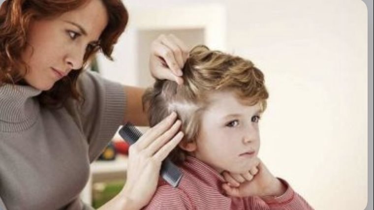 طرق التخلص من القمل.. خطوات فعالة للقضاء عليه ومنع عودته